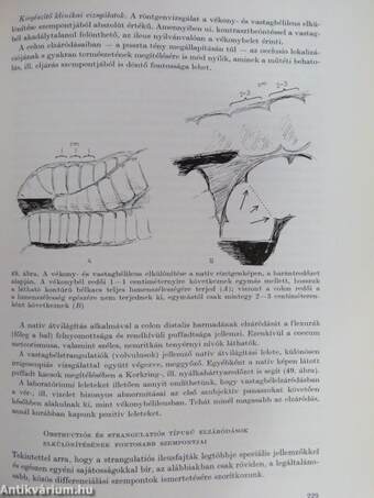 Heveny hasi kórképek fizikális diagnosztikája