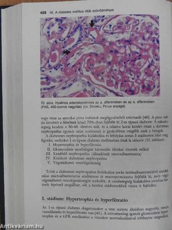 Diabetes mellitus