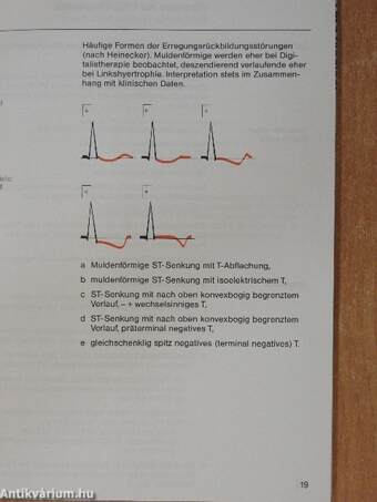 Praxis der EKG-Beurteilung