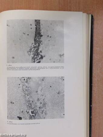 Korai és késői terhességi toxicosis (dedikált példány)