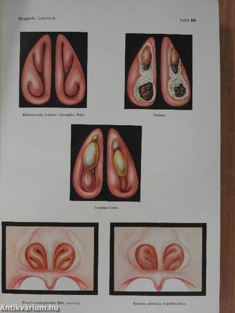 Lehrbuch der inneren Medizin in zwei Bänden I-II.