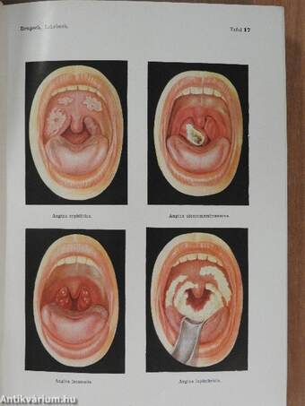 Lehrbuch der inneren Medizin in zwei Bänden I-II.