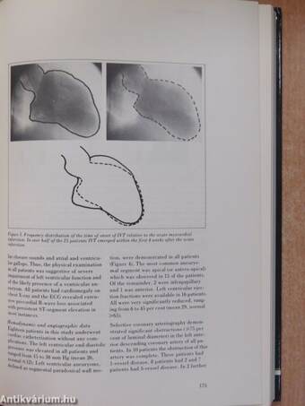 Acute and Long-Term Medical Management of Myocardial Ischaemia