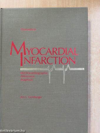 Myocardial Infarction