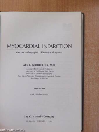 Myocardial Infarction