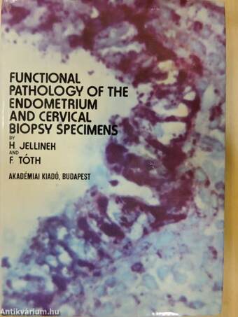 Functional Pathology of the Endometrium and Cervical Biopsy Specimens