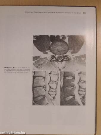 Computed Tomography of the Body With Magnetic Resonance Imaging II.