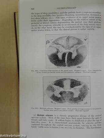 A Text-Book of Pathology