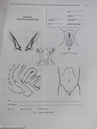 International Journal of Gynecology & Obstetrics August 2000