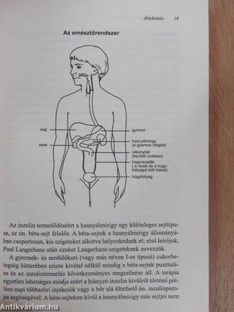 Ha a gyermek cukorbeteg