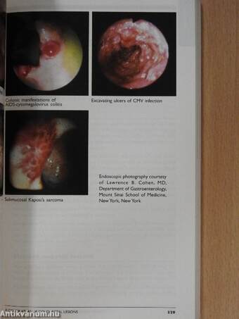 Cancer Management: A Multidisciplinary Approach