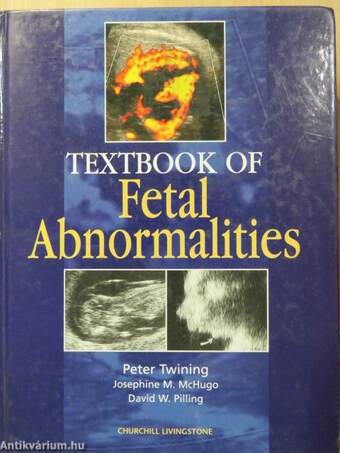 Textbook of Fetal Abnormalities