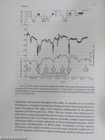 Asthma and Bronchial Hyperreactivity