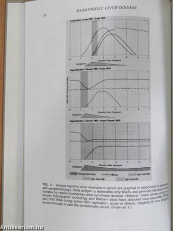 Hemophilia in the Child and Adult