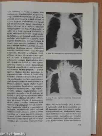 A mediastinum tumorai és pseudotumorai