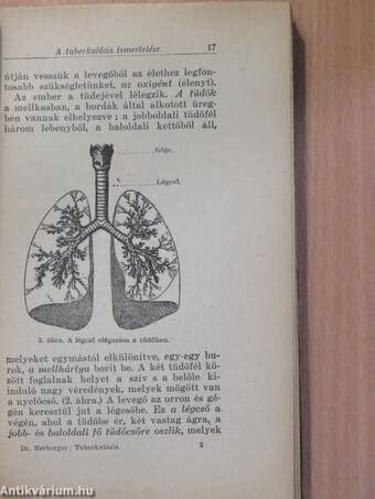 A tüdőbaj (tuberkulózis) megelőzése és otthoni gyógyítása