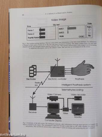 Prosthetics and Orthotics International April 2002