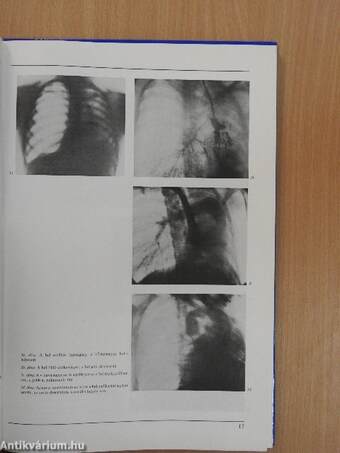 A gátor betegségeinek radiológiai diagnosztikája és gyógyítása