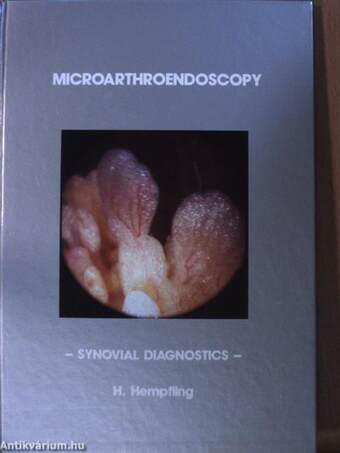 Microarthroendoscopy