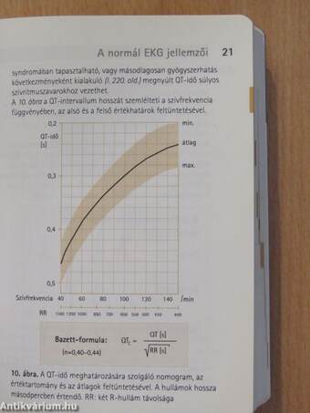 Elektrokardiográfia az orvosi gyakorlatban