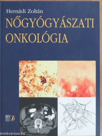 Nőgyógyászati onkológia