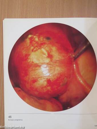 Atlas of laparoscopy