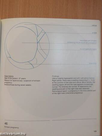 Atlas of laparoscopy