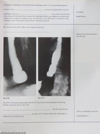 A programmed introduction to upper gastrointestinal radiology