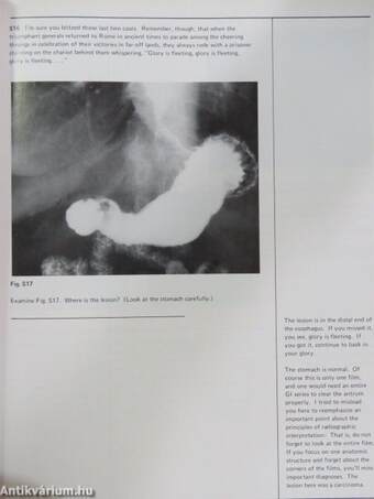 A programmed introduction to upper gastrointestinal radiology