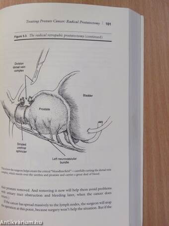 The Prostate (dedikált példány)