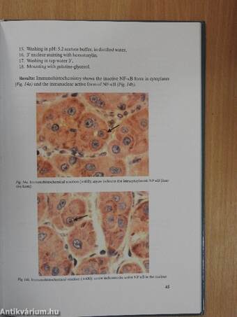 The Etiological Role of Hepatitis C Virus in Lymphomagenesis