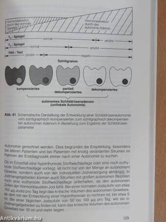 Schilddrüsenkrankheiten