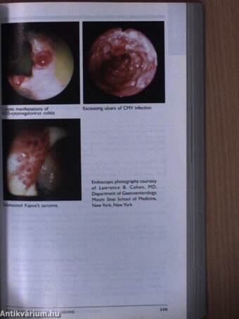 Cancer Management: A Multidisciplinary Approach