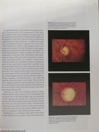 Introduction to Ophthalmoscopy