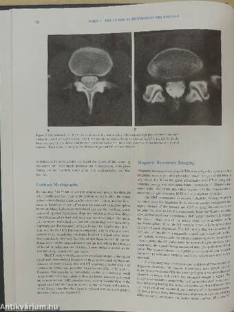 Principles of Neurology