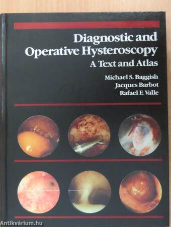 Diagnostic and Operative Hysteroscopy: A Text and Atlas