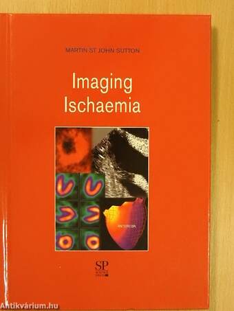 Imaging Ischaemia