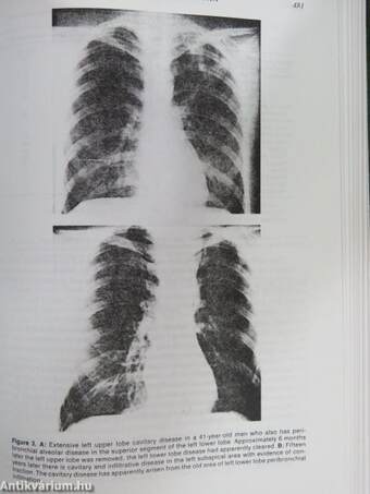 Respiratory Infections: Diagnosis and Management