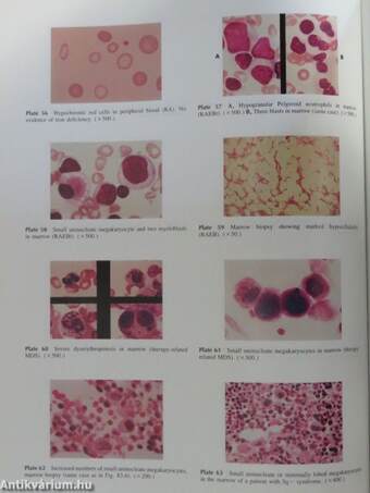 Hematology I-II.