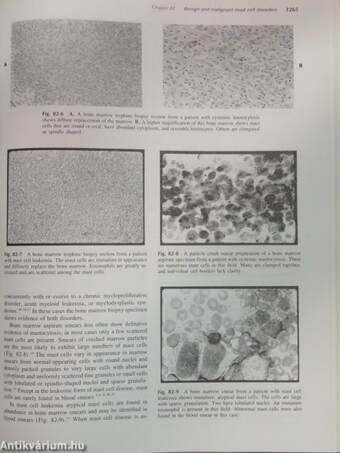 Hematology I-II.