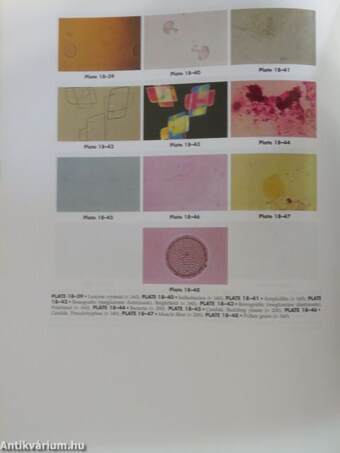 Clinical Diagnosis and Management by Laboratory Methods