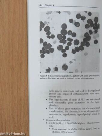 Dx/Rx: Leukemia