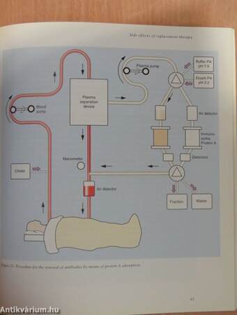 Hemophilia