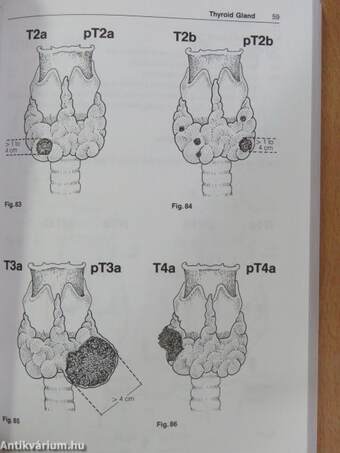 TNM Atlas