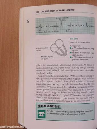 Az EKG helyes értelmezése