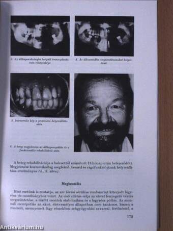 Fogorvosi Szemle 1994. június