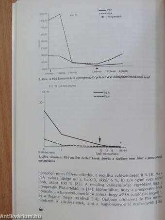 A prosztatarák diagnosztikája és terápiája