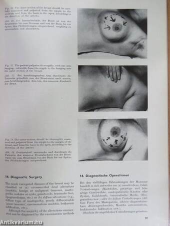 Atlas of the Diseases of the Mammary Gland/Atlas der Brustdrüsen-erkrankungen