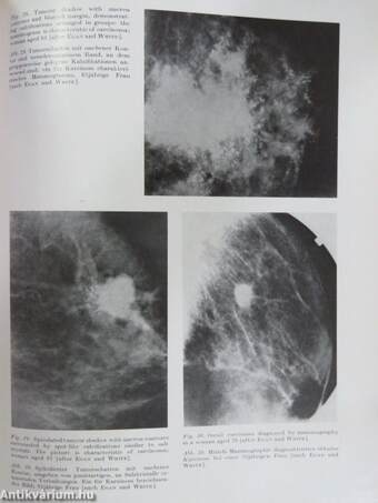 Atlas of the Diseases of the Mammary Gland/Atlas der Brustdrüsen-erkrankungen