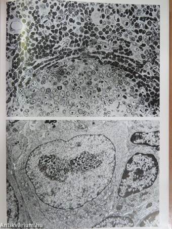 Ultrastructure of lymphoid organs